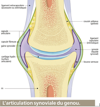 Comment diagnostiquer l'arthrose ?