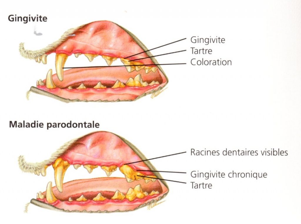 gingivite-et-maladie-parodontale